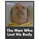 The Man Who Lost His Body